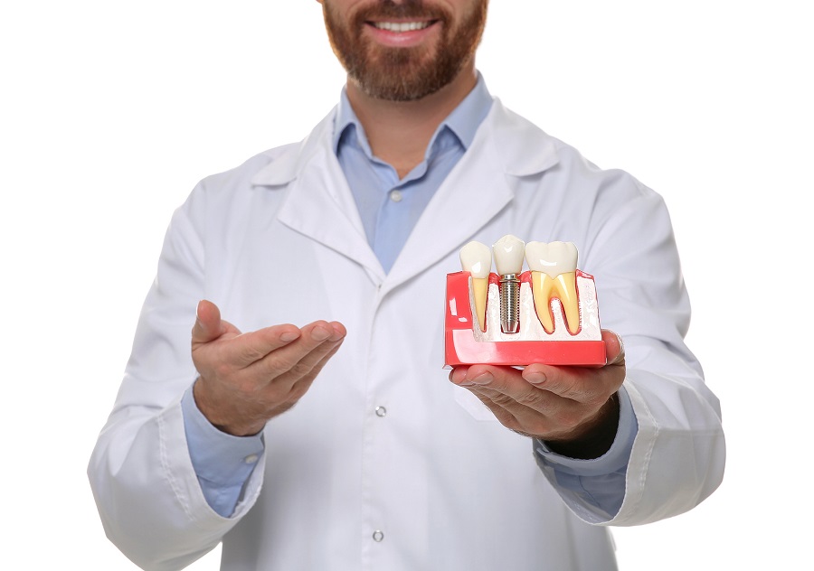 Dental Implant – Is It Worth Your Money?
