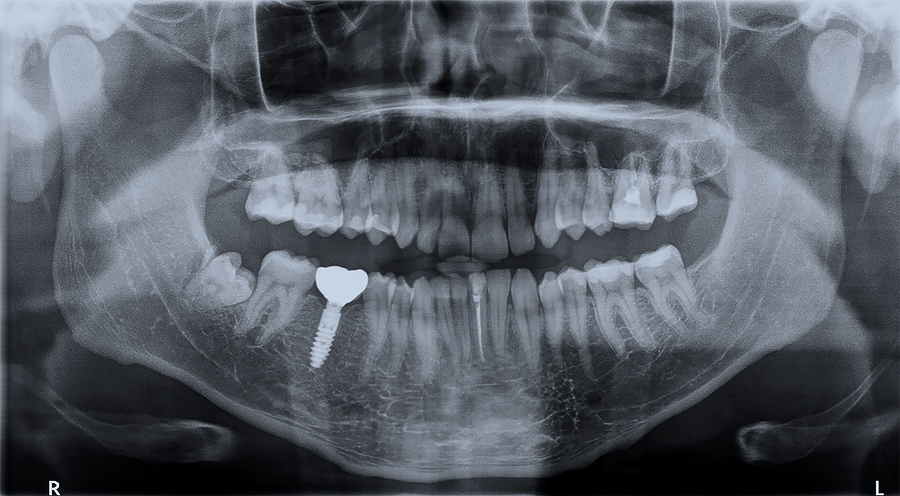 Advanced Dental Care with Digital Imaging in Boise, ID
