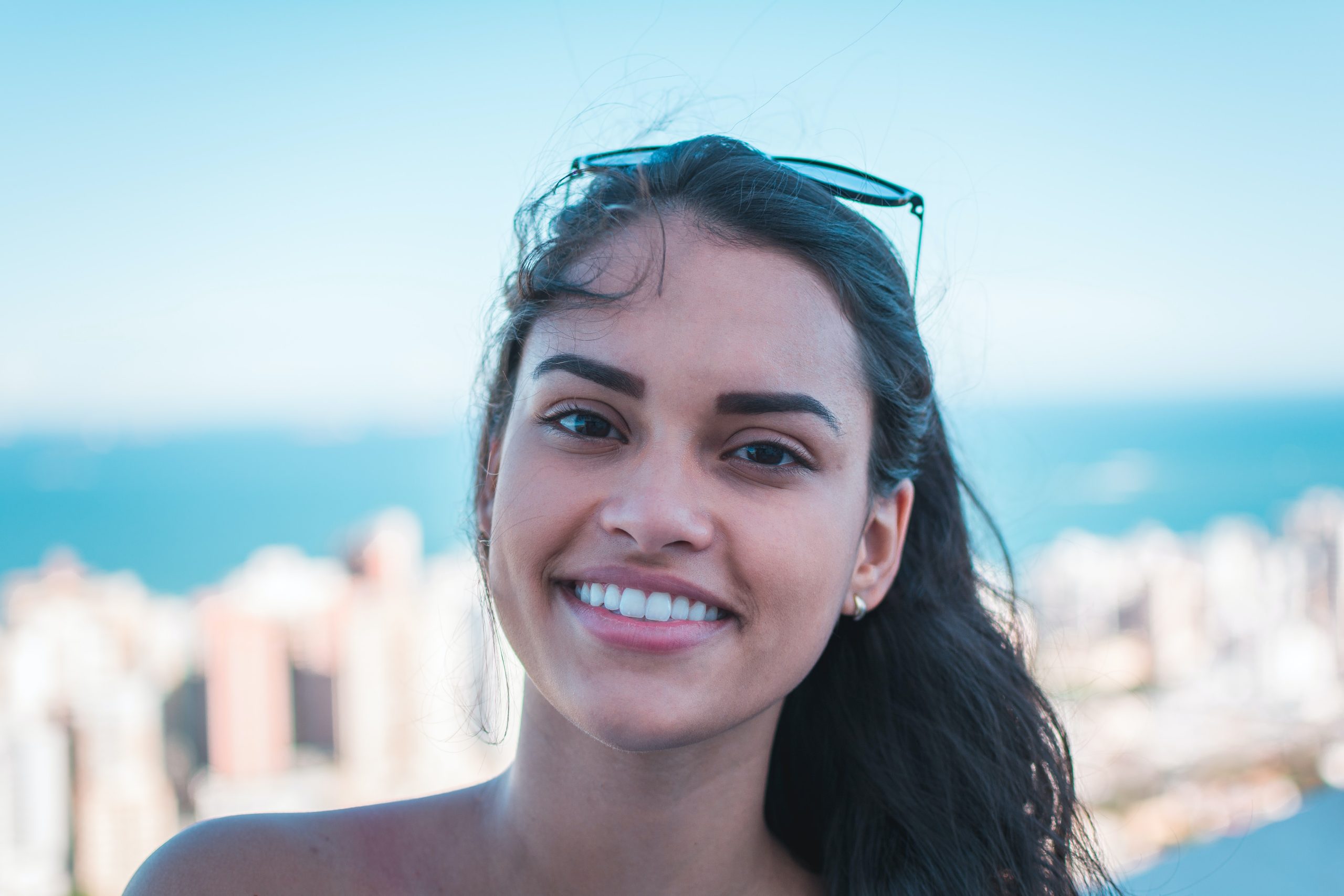 The Importance of Teeth Whitening